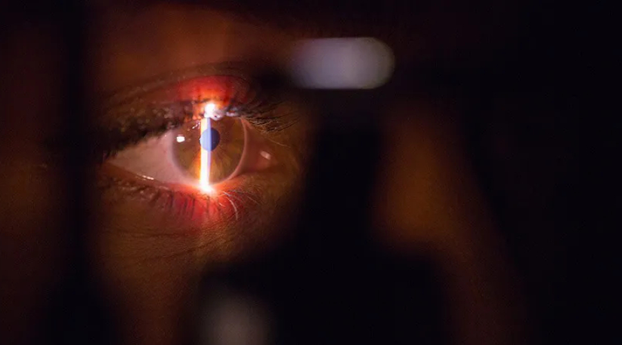 Se faire opérer des yeux : comment et pourquoi ?