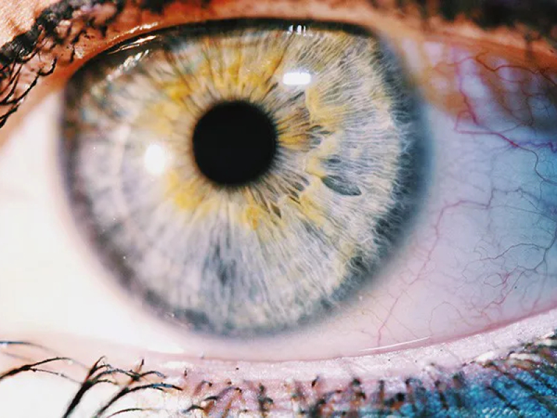 Comment le daltonisme altère la vision ?