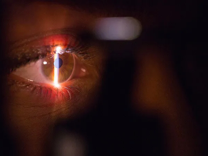 Se faire opérer des yeux : comment et pourquoi ?