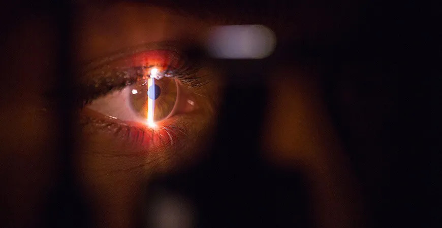 Se faire opérer des yeux : comment et pourquoi ?
